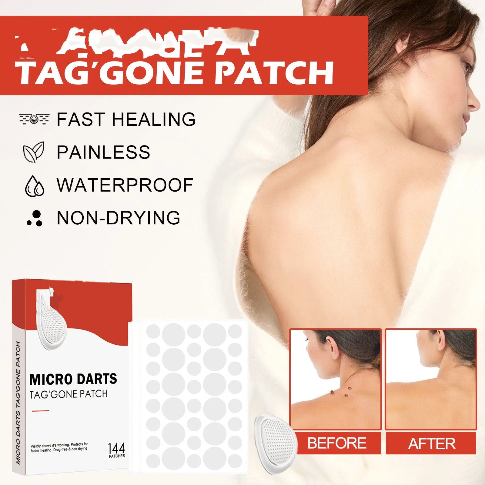 Acne Patch – Blemish Spot Treatment & Dark Spot Fade Stickers