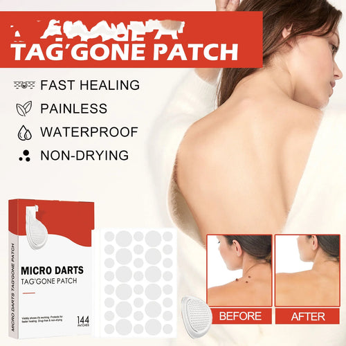 Acne Patch – Blemish Spot Treatment & Dark Spot Fade Stickers
