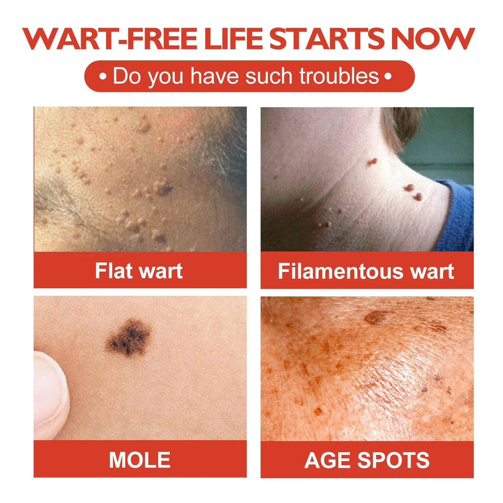 Acne Patch – Blemish Spot Treatment & Dark Spot Fade Stickers