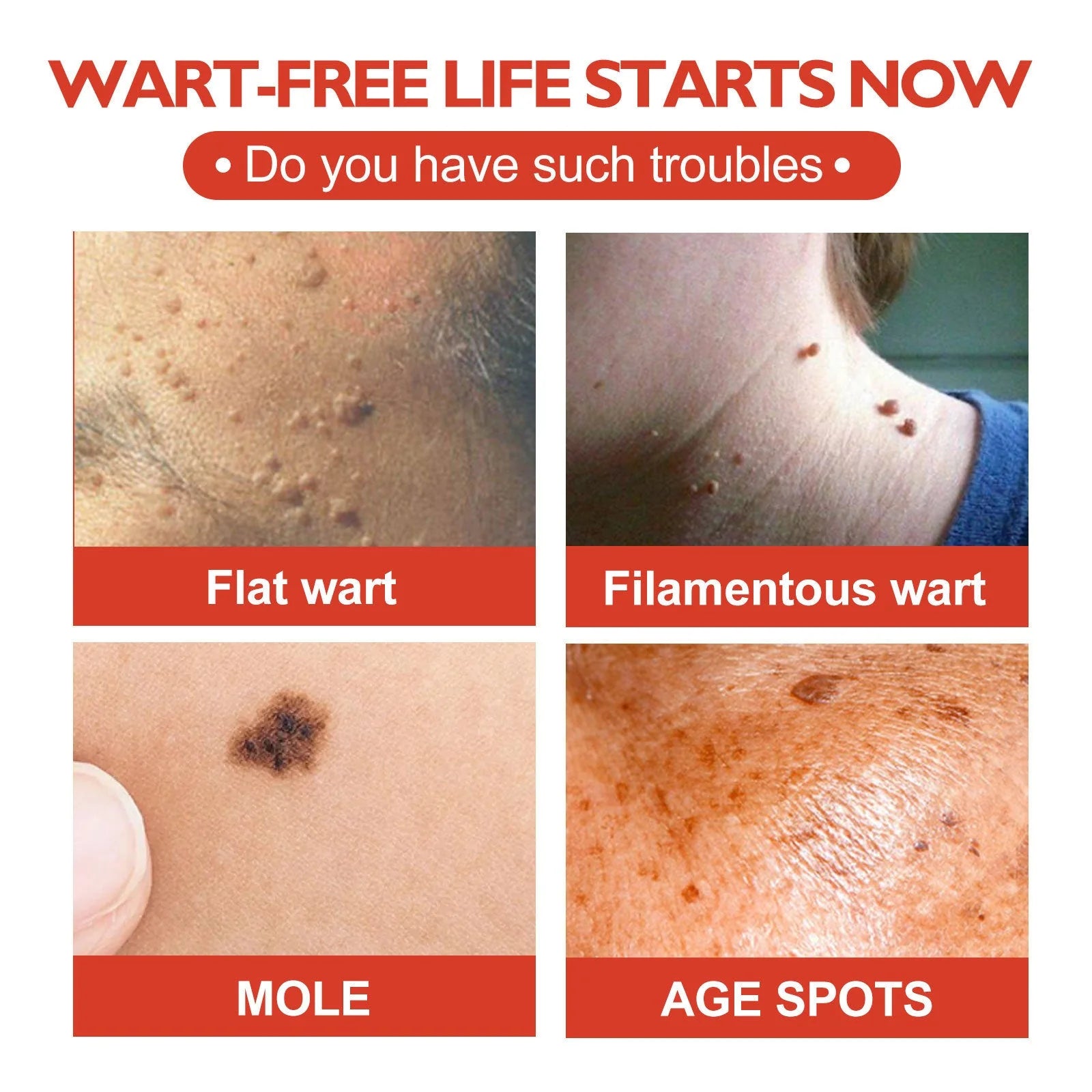 Acne Patch – Blemish Spot Treatment & Dark Spot Fade Stickers