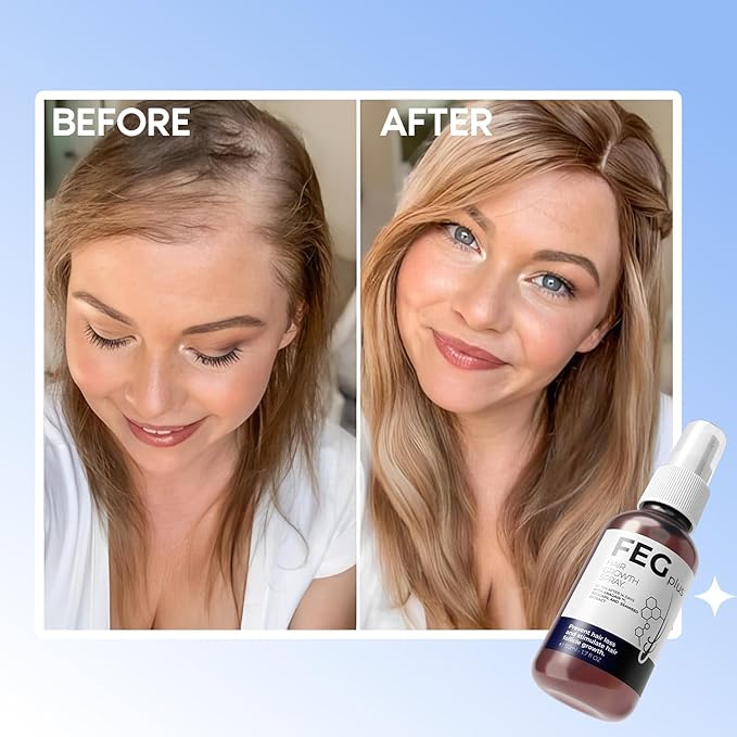 FEG Plus Hair Growth Spray – Nourishing Scalp & Hair Care
