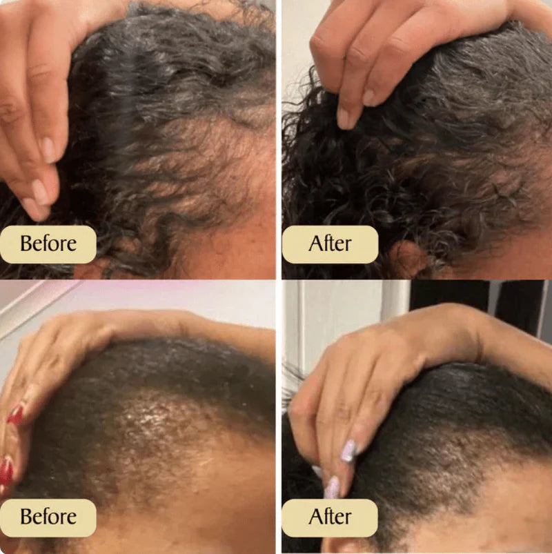 Hair Growth Oil – Nourishing Scalp & Hair Care Oil | UAE