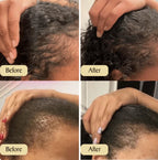 Hair Growth Oil – Nourishing Scalp & Hair Care Oil | UAE